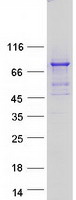 PPM1D / WIP1 Protein - Purified recombinant protein PPM1D was analyzed by SDS-PAGE gel and Coomassie Blue Staining