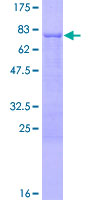 PPM1F Protein - 12.5% SDS-PAGE of human PPM1F stained with Coomassie Blue