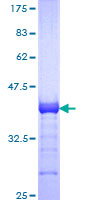 PPM1F Protein - 12.5% SDS-PAGE Stained with Coomassie Blue.