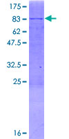 PPM1J Protein - 12.5% SDS-PAGE of human PPM1J stained with Coomassie Blue