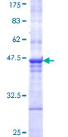 PPM1J Protein - 12.5% SDS-PAGE Stained with Coomassie Blue.
