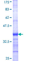 PPM1M Protein - 12.5% SDS-PAGE Stained with Coomassie Blue.