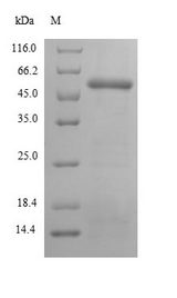 PPOX Protein - (Tris-Glycine gel) Discontinuous SDS-PAGE (reduced) with 5% enrichment gel and 15% separation gel.