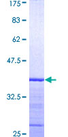 PPOX Protein - 12.5% SDS-PAGE Stained with Coomassie Blue.