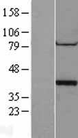 PPP1CA / PP1-Alpha Protein - Western validation with an anti-DDK antibody * L: Control HEK293 lysate R: Over-expression lysate