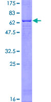 PPP1CA / PP1-Alpha Protein - 12.5% SDS-PAGE of human PPP1CA stained with Coomassie Blue