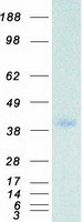 PPP1CC / PP1 Gamma Protein - Purified recombinant protein PPP1CC was analyzed by SDS-PAGE gel and Coomassie Blue Staining