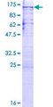 PPP1R10 / PNUTS Protein - 12.5% SDS-PAGE of human PPP1R10 stained with Coomassie Blue