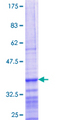 PPP1R10 / PNUTS Protein - 12.5% SDS-PAGE Stained with Coomassie Blue.