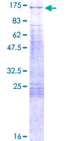PPP1R13L / iASPP Protein - 12.5% SDS-PAGE of human PPP1R13L stained with Coomassie Blue