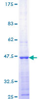 PPP1R13L / iASPP Protein - 12.5% SDS-PAGE Stained with Coomassie Blue.