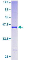 PPP1R14A / CPI-17 Protein - 12.5% SDS-PAGE of human PPP1R14A stained with Coomassie Blue