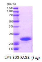 PPP1R14A / CPI-17 Protein