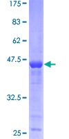 PPP1R14B Protein - 12.5% SDS-PAGE of human PPP1R14B stained with Coomassie Blue