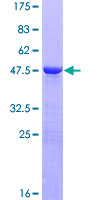 PPP1R14C / KEPI Protein - 12.5% SDS-PAGE of human PPP1R14C stained with Coomassie Blue