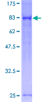 PPP1R16A Protein - 12.5% SDS-PAGE of human PPP1R16A stained with Coomassie Blue
