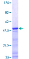 PPP1R17 / C7orf16 Protein - 12.5% SDS-PAGE of human C7orf16 stained with Coomassie Blue