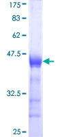 PPP1R17 / C7orf16 Protein