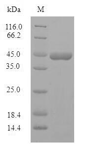 PPP1R1B / DARPP-32 Protein - (Tris-Glycine gel) Discontinuous SDS-PAGE (reduced) with 5% enrichment gel and 15% separation gel.