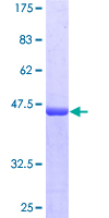 PPP1R1C Protein - 12.5% SDS-PAGE of human PPP1R1C stained with Coomassie Blue