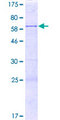 PPP1R21 / KLRAQ1 Protein - 12.5% SDS-PAGE of human PPP1R21 stained with Coomassie Blue