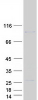 PPP1R21 / KLRAQ1 Protein - Purified recombinant protein PPP1R21 was analyzed by SDS-PAGE gel and Coomassie Blue Staining