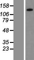 PPP1R3A / GM Protein - Western validation with an anti-DDK antibody * L: Control HEK293 lysate R: Over-expression lysate