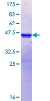 PPP1R3A / GM Protein - 12.5% SDS-PAGE Stained with Coomassie Blue.