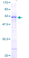 PPP1R3B Protein - 12.5% SDS-PAGE of human PPP1R3B stained with Coomassie Blue