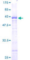 PPP1R3B Protein - 12.5% SDS-PAGE of human PPP1R3B stained with Coomassie Blue