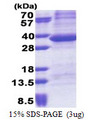 PPP1R3B Protein