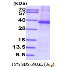 PPP1R3B Protein