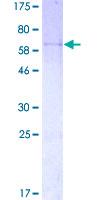 PPP1R3C / PTG Protein - 12.5% SDS-PAGE of human PPP1R3C stained with Coomassie Blue