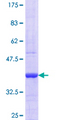 PPP1R3C / PTG Protein - 12.5% SDS-PAGE Stained with Coomassie Blue