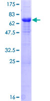 PPP1R7 Protein - 12.5% SDS-PAGE of human PPP1R7 stained with Coomassie Blue