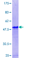 PPP1R7 Protein - 12.5% SDS-PAGE Stained with Coomassie Blue
