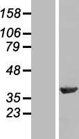 PPP1R8 / Rnase E Protein - Western validation with an anti-DDK antibody * L: Control HEK293 lysate R: Over-expression lysate