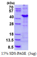 PPP1R8 / Rnase E Protein