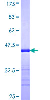PPP1R9B / Spinophilin Protein - 12.5% SDS-PAGE Stained with Coomassie Blue.