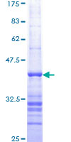 PPP2R1B Protein - 12.5% SDS-PAGE Stained with Coomassie Blue.