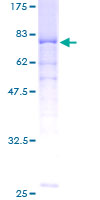PPP2R2A Protein - 12.5% SDS-PAGE of human PPP2R2A stained with Coomassie Blue