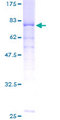 PPP2R2A Protein - 12.5% SDS-PAGE of human PPP2R2A stained with Coomassie Blue