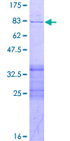 PPP2R2B Protein - 12.5% SDS-PAGE of human PPP2R2B stained with Coomassie Blue