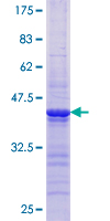 PPP2R2B Protein - 12.5% SDS-PAGE Stained with Coomassie Blue.