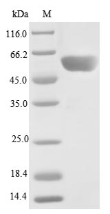 PPP2R2C Protein - (Tris-Glycine gel) Discontinuous SDS-PAGE (reduced) with 5% enrichment gel and 15% separation gel.