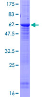 PPP2R2D Protein - 12.5% SDS-PAGE of human PPP2R2D stained with Coomassie Blue