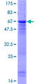 PPP2R2D Protein - 12.5% SDS-PAGE of human PPP2R2D stained with Coomassie Blue