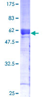 PPP2R3B Protein - 12.5% SDS-PAGE of human PPP2R3B stained with Coomassie Blue