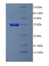 PPP2R3B Protein