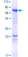PPP2R3C Protein - 12.5% SDS-PAGE of human PPP2R3C stained with Coomassie Blue